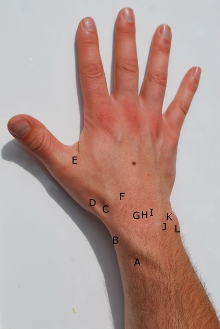 dorsal wrist impingement symptoms