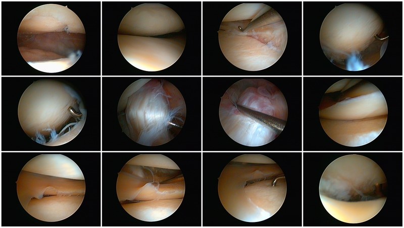 inside-the-knee